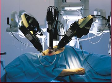 robotics surgery